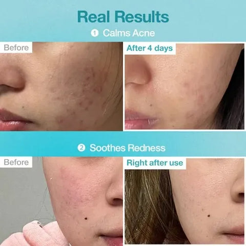 Numbuzin -  No.1 Pantothenic B5 Hyaluronic Active Clear Mask 5ea