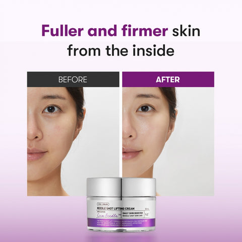 VT - REEDLE SHOT LIFTING CREAM 50ML